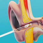 Smart Ear Hygiene Swabs™
